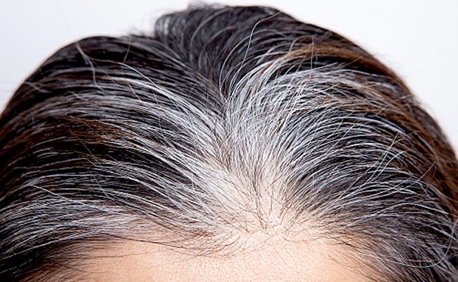 Grey hair might be the most unlikely cancer fighter