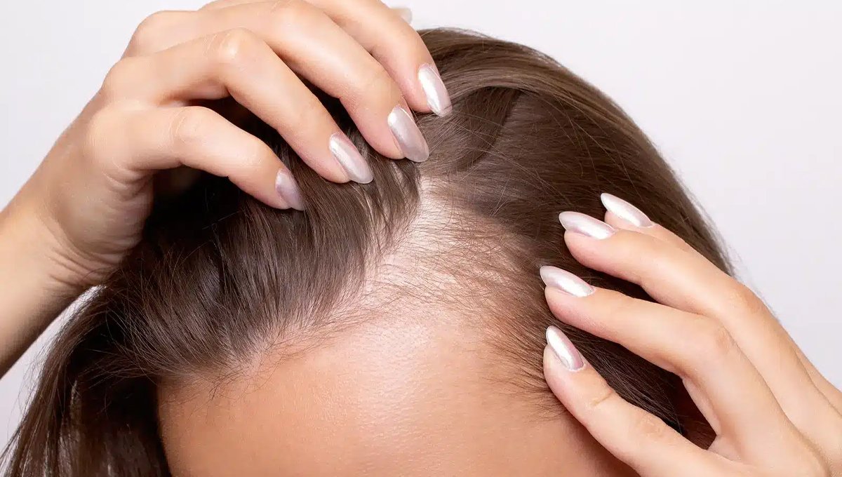 Major cause of hair loss in men revealed: New study makes surprising revelation