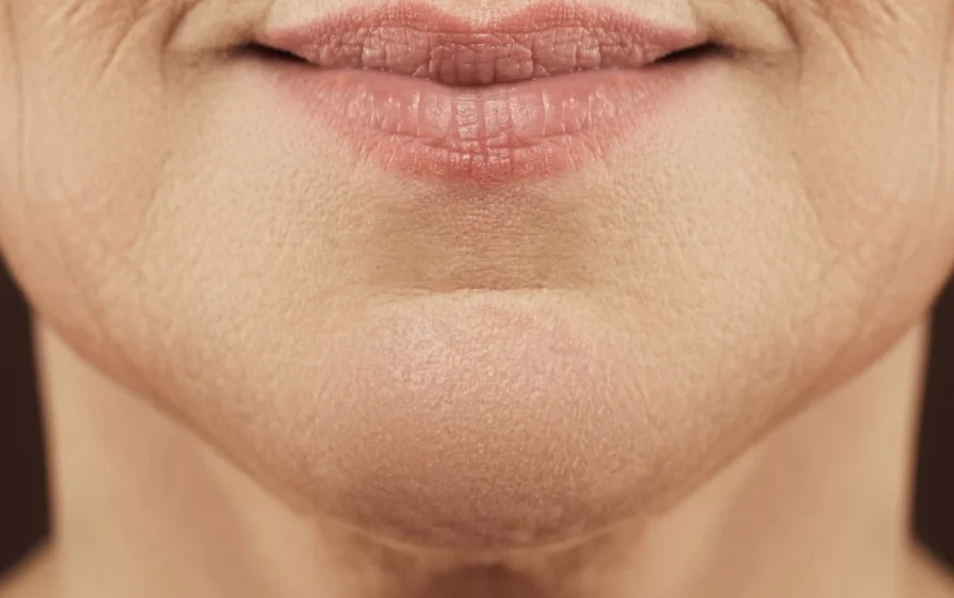 The common habit causing premature aging in young people