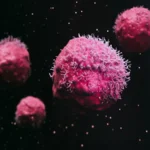 cancer