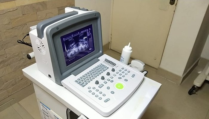 Ultrasound machine worth millions stolen from Mansehra DHQ Hospital