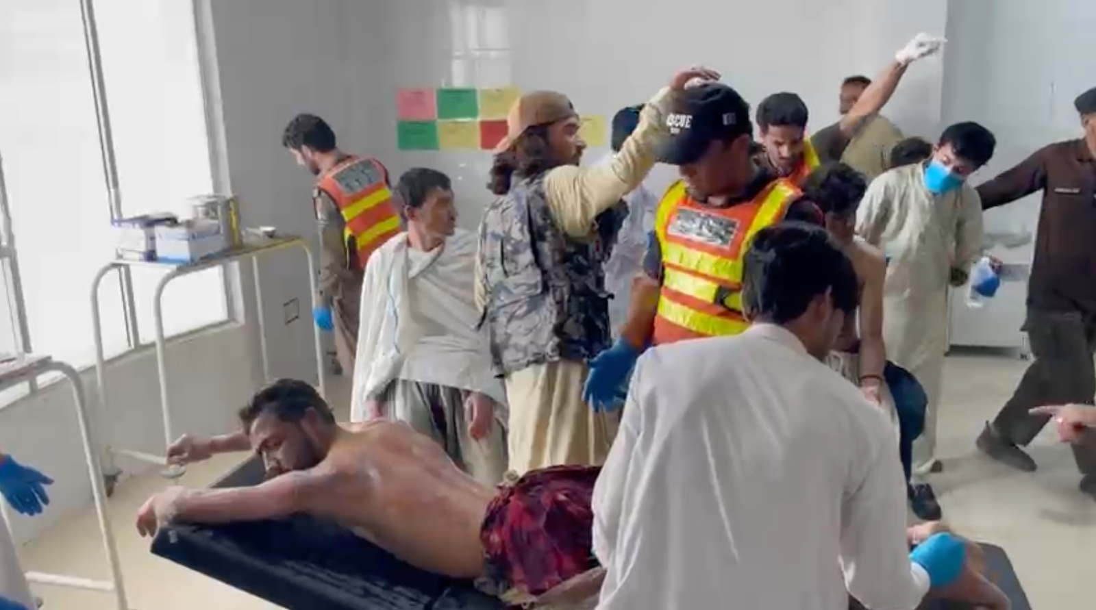 Tragic incident leaves 16 with burn injuries