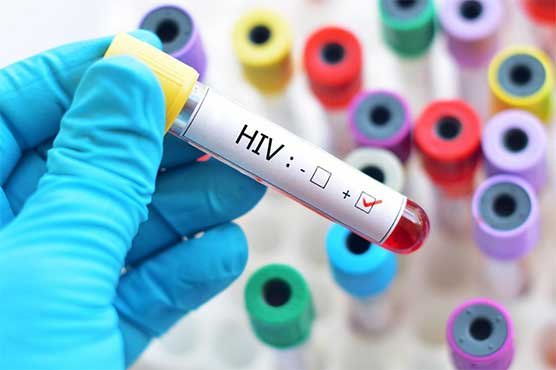 HIV cases surge in KP, Health experts raise alarm