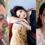 Renowned actress Saveera Nadeem has opened up about her ongoing journey to address acne scars, sharing her experience and unfiltered images with the public.