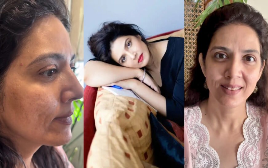 Renowned actress Saveera Nadeem has opened up about her ongoing journey to address acne scars, sharing her experience and unfiltered images with the public.