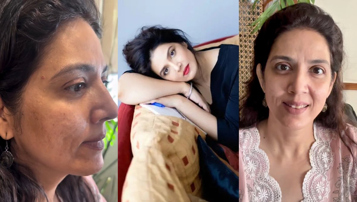 No filters, no fear: Saveera Nadeem shares unfiltered look amid acne scar treatment