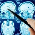 neurosurgeon
