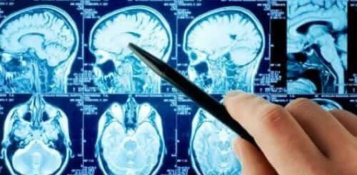 Young neurosurgeon from KP achieves major medical breakthrough