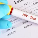 HIV, Mardan