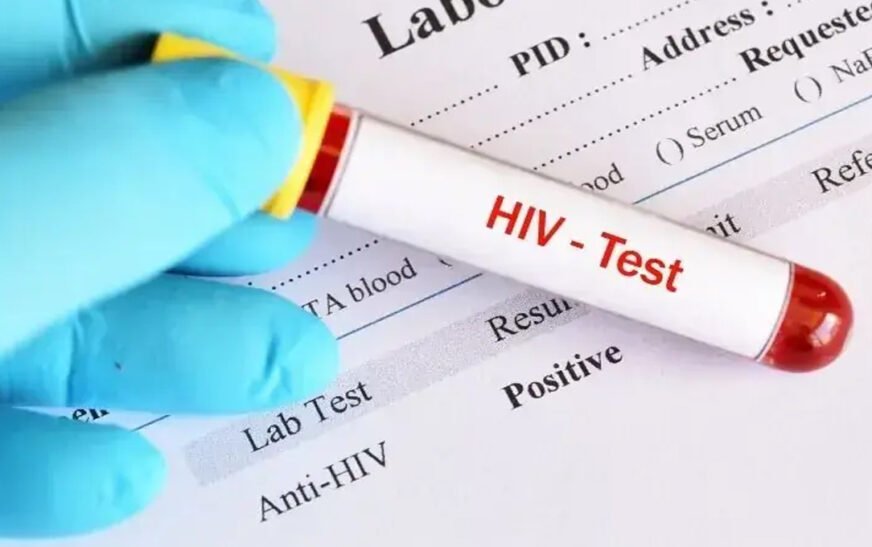HIV, Mardan