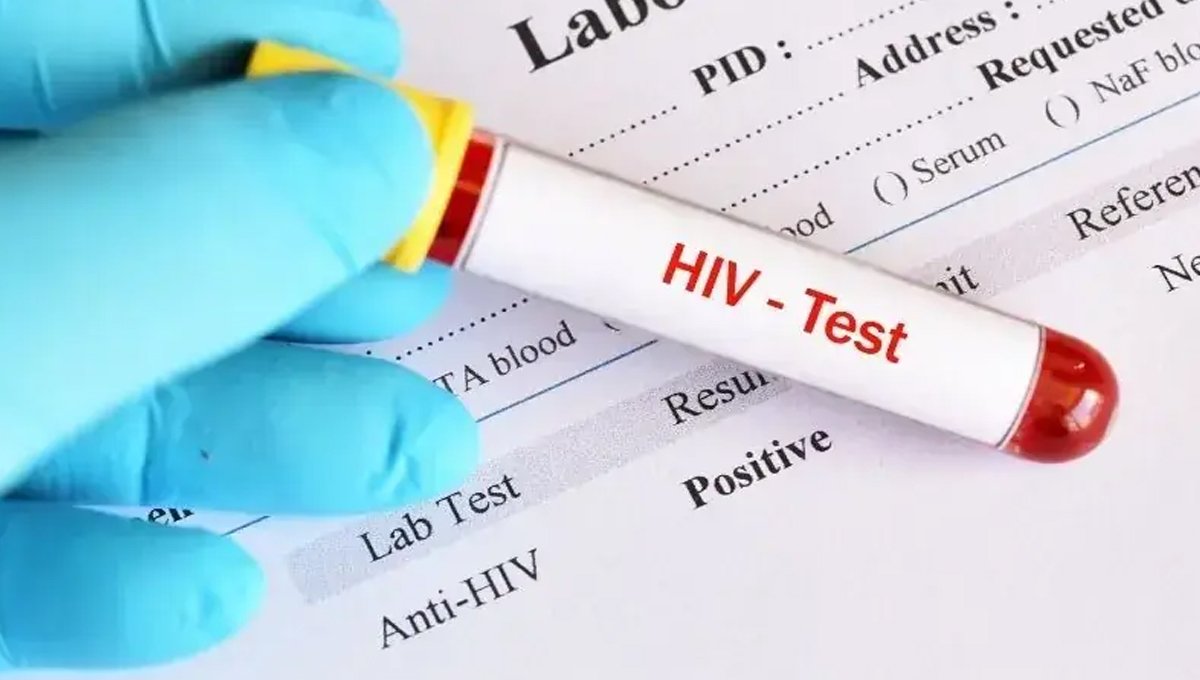 HIV Cases Rise in Mardan as 471 Patients Receive Treatment at DHQ Hospital