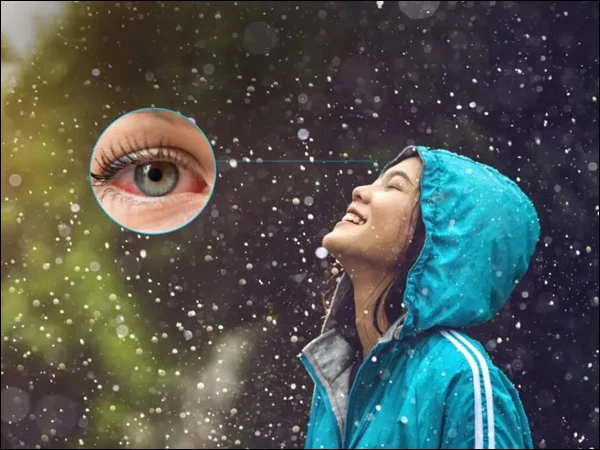 Experts warn of conjunctivitis cases during monsoon season