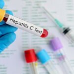 hepatitis C