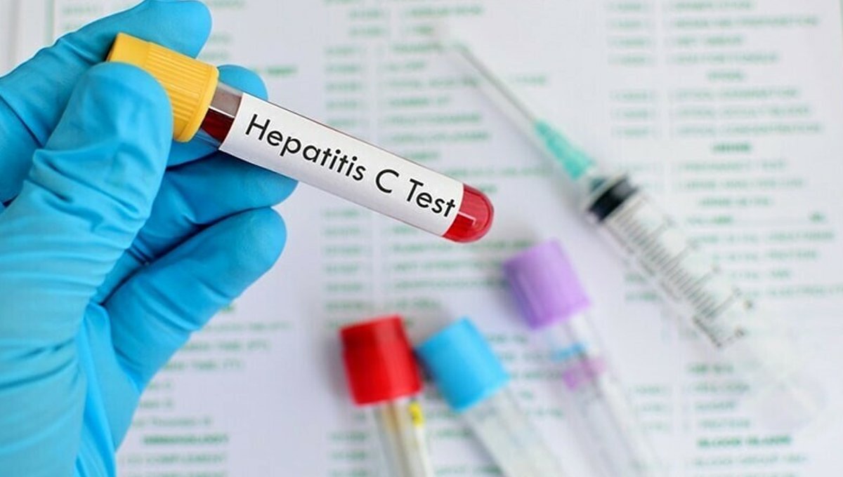 No Hepatitis C Test, No Salary? Federal Minister Issues Major Warning