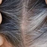 hair