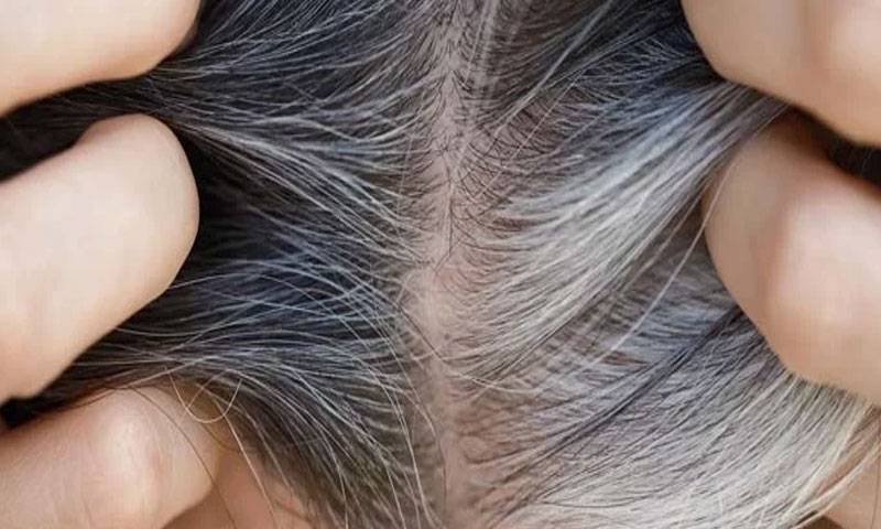 Why hair turns grey early, study reveals major cause
