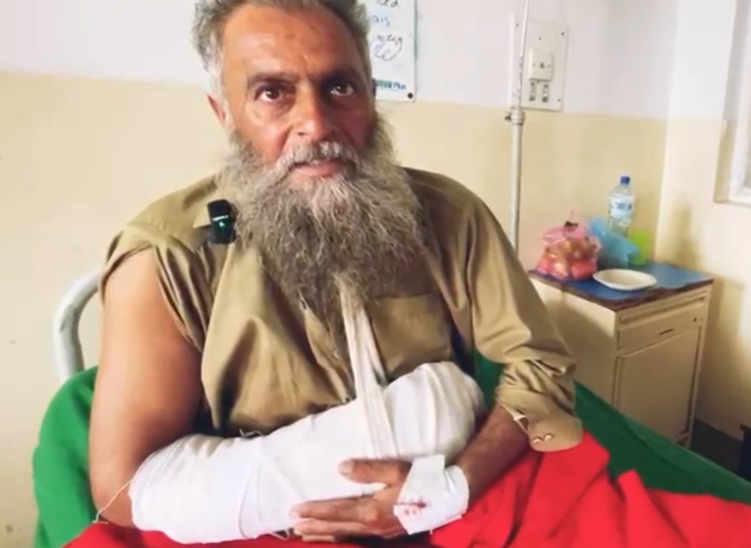 Historic surgery in Ayub Teaching Hospital: Hand severed by a Saw machine successfully reattached