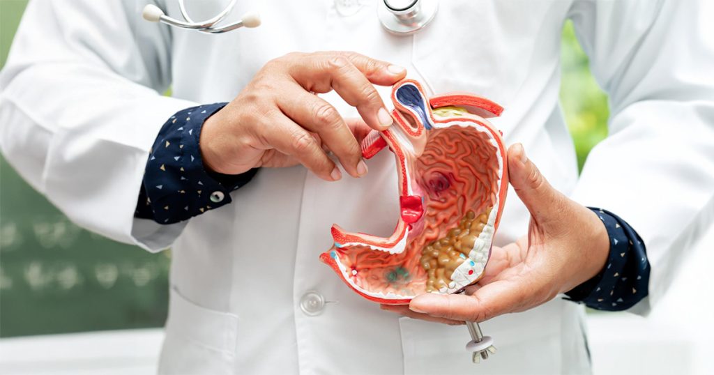 Stomach Cancer: 8 Warning Signs We Should Never Ignore