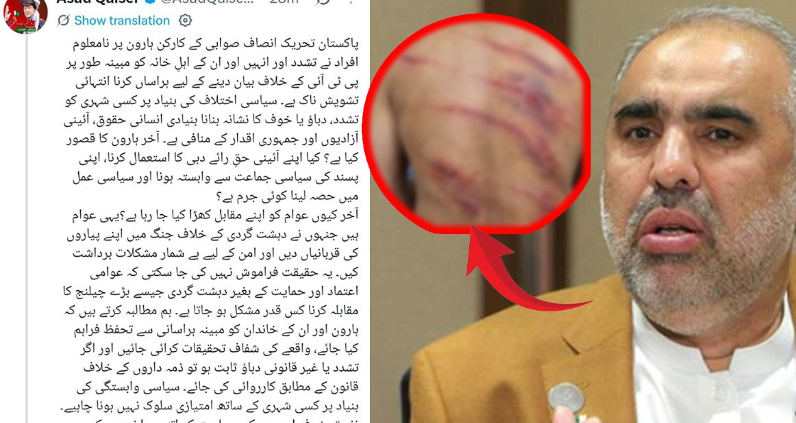 PTI MNA Asad Qaiser’s false propaganda exposed: Social Media Fact-Check reveals fake images of torture